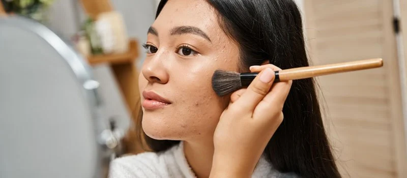 Rahasia Skincare Aman untuk Kulit Acne Prone
