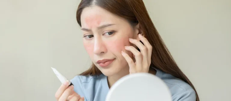 ciri-ciri kulit sensitif