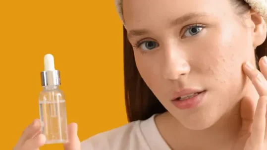 skincare untuk jerawat