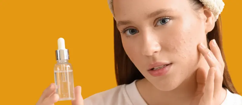 skincare untuk jerawat