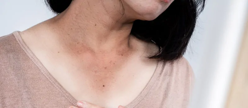 5 Cara Menghilangkan Daki di Leher dengan Mudah