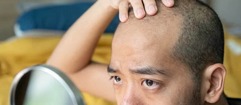 Oleanolic Acid untuk Atasi Rontok dan Kebotakan