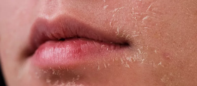 Mengenal Istilah Pilling dalam Penggunaan Skincare