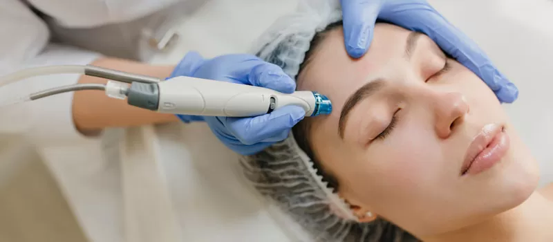 Pilihan Skincare Aman untuk Pengganti Dermapen