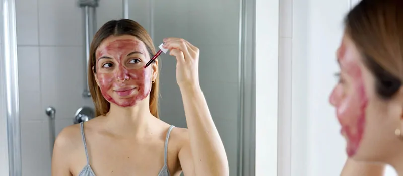 apa itu chemical peel