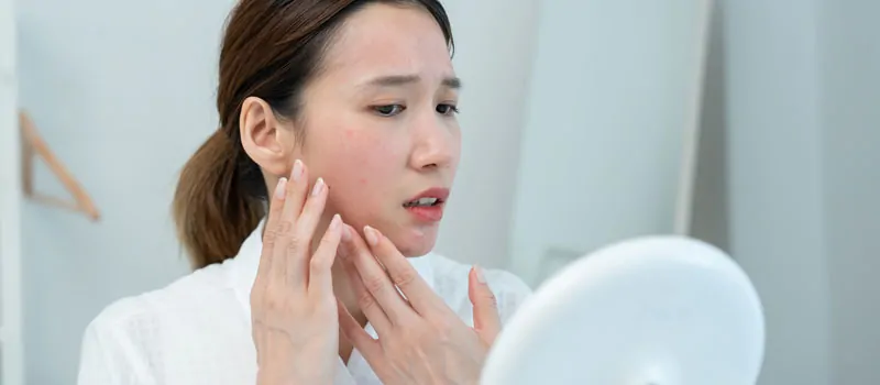 Sensitized Skin: Pengertian, Penyebab, dan Solusinya