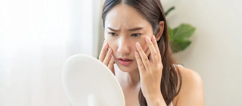 Apa Itu Sebum Control dalam Inovasi Skincare?