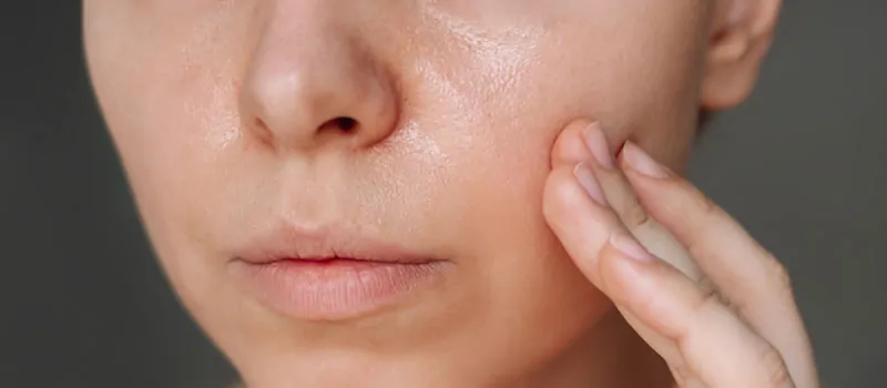 tanda pori-pori tersumbat