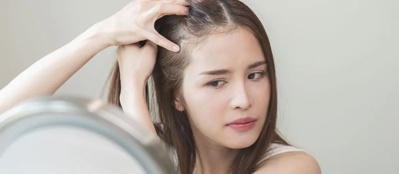 penyebab garis rambut mundur